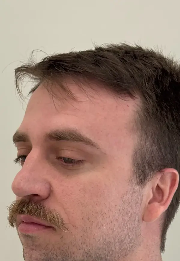 Antes: perfil masculino