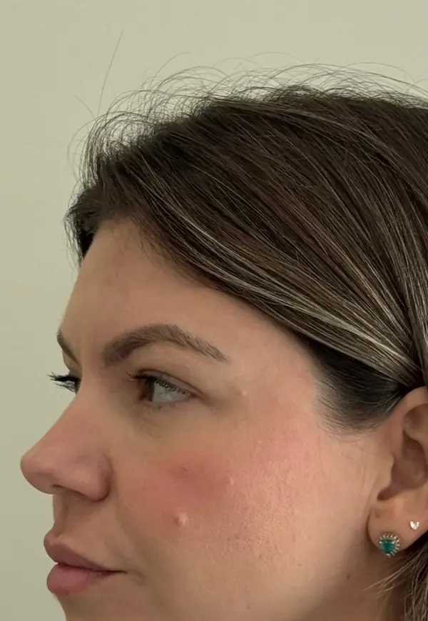 Antes: perfil