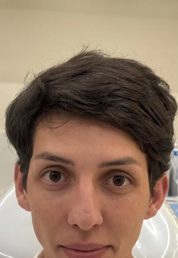 Antes: rosto de frente
